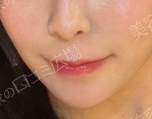 治療結果の症例写真