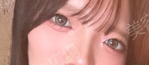治療前の症例写真