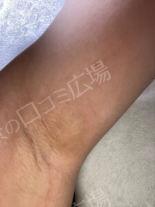 治療結果の症例写真