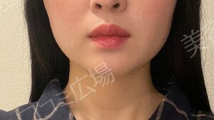 治療前の症例写真
