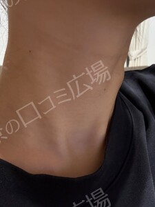 治療結果の症例写真