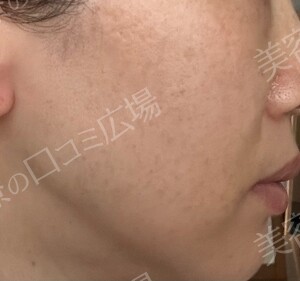 治療結果の症例写真