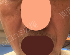 治療結果の症例写真