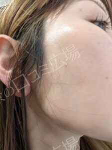 治療前の症例写真