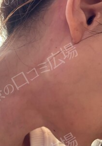 治療結果の症例写真