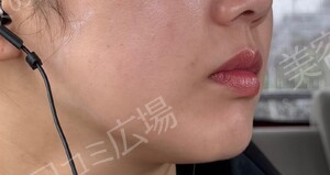 治療結果の症例写真