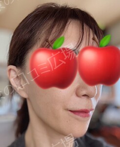 治療結果の症例写真