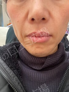 治療前の症例写真