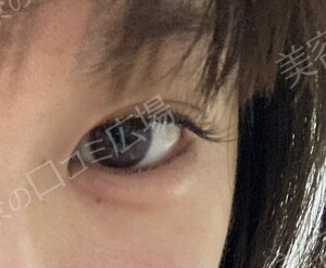 治療結果の症例写真