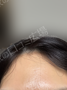 治療結果の症例写真