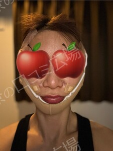 治療直後の症例写真