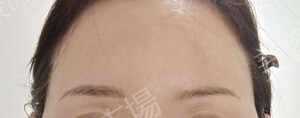 治療前の症例写真