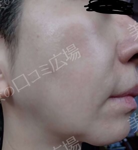 治療前の症例写真