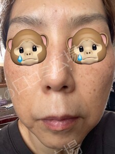 治療前の症例写真