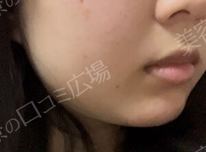 治療前の症例写真
