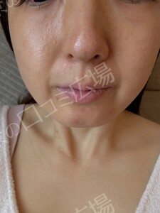 治療前の症例写真