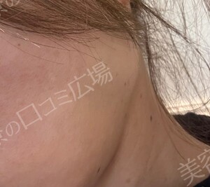 治療前の症例写真