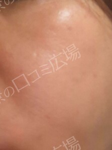 治療結果の症例写真
