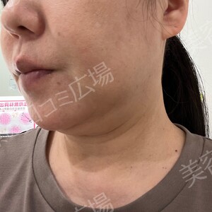 治療結果の症例写真