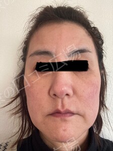治療結果の症例写真