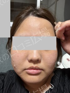 治療結果の症例写真