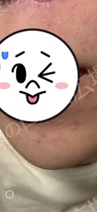 治療結果の症例写真