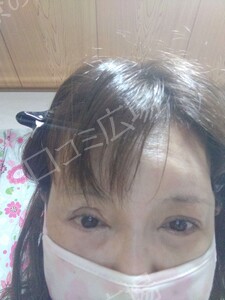 治療前の症例写真