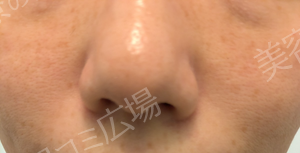 治療前の症例写真