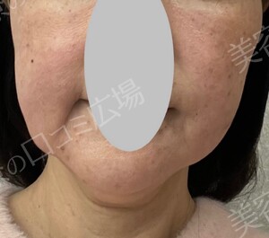 治療前の症例写真