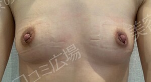 治療直後の症例写真
