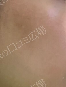 治療結果の症例写真