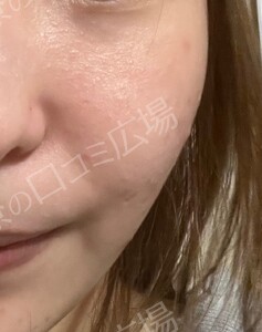 治療結果の症例写真