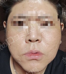 治療結果の症例写真