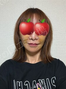 治療直後の症例写真