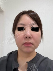 治療前の症例写真
