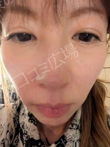 治療結果の症例写真