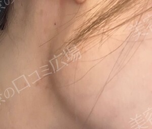 治療前の症例写真