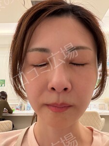 治療前の症例写真