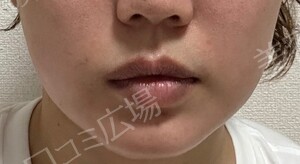 治療結果の症例写真