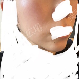 治療結果の症例写真