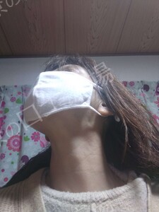 治療結果の症例写真