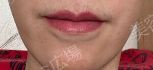 治療前の症例写真