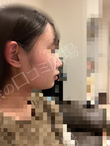 治療直後の症例写真