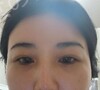施術前の状態