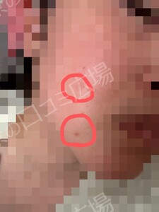 治療結果の症例写真