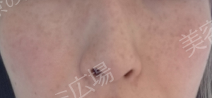 治療前の症例写真