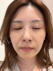 治療前の症例写真