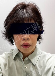 治療結果の症例写真