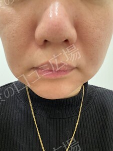 治療前の症例写真