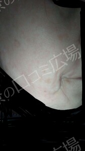 治療結果の症例写真